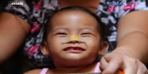 Batang babae, natapyasan ang ilong dahil sa sakmal ng aso; 4 pa .